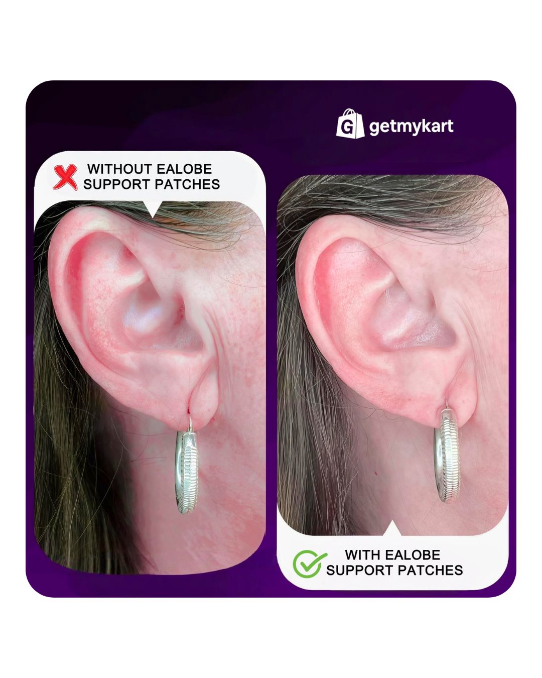 Earlobe Support Patches